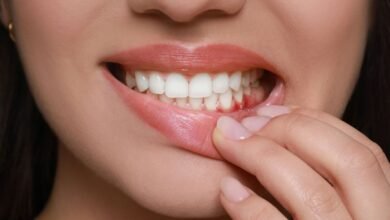 Sangramento na Gengiva: o que pode ser e quando é sinal de alerta 2025